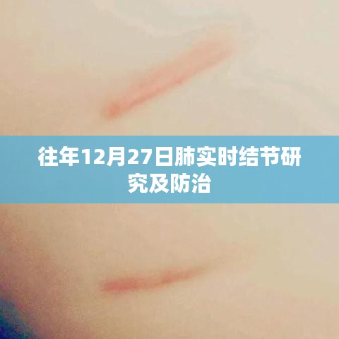 肺实时结节研究及防治进展，历年观察与防治策略