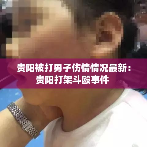 贵阳被打男子伤情情况最新：贵阳打架斗殴事件 