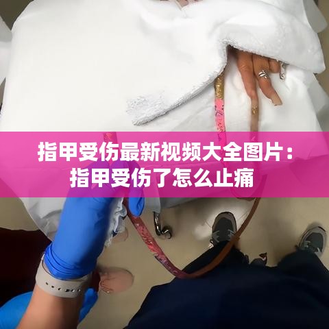 指甲受伤最新视频大全图片：指甲受伤了怎么止痛 